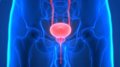 Un nouveau projet européen vise à réduire la mortalité par cancer de la prostate et à éviter les surdiagnostics