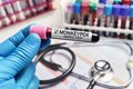 L'ECDC note que l'UE « est susceptible » de signaler davantage de cas importés de la nouvelle variante mpox