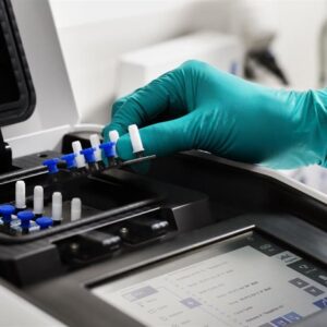 L'UE alloue 2,1 millions d'euros aux tests PCR pour l'OMS contre l'épidémie d'Ebola en RDC